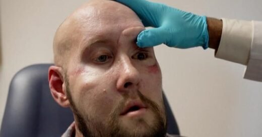 Eye on America: Successful eye transplant, and the healing power of breathing