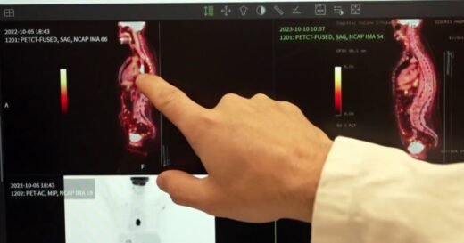 Major breakthrough in cancer treatment