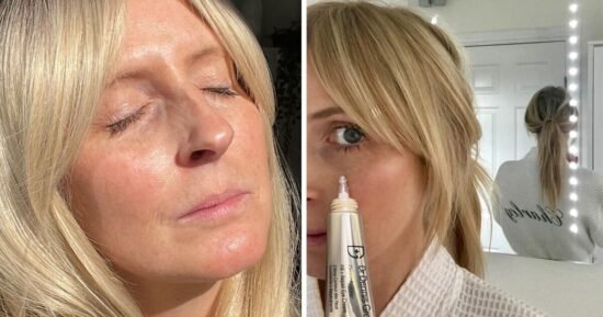 The eye cream that stopped a beauty editor getting botox