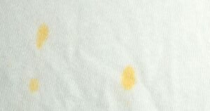 Remove yellow sun cream stains from clothing instantly with ‘amazing’ item