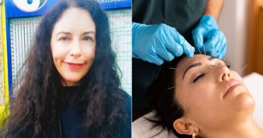 I tried acupuncture and had an unexpected experience – it was astonishing | UK | News