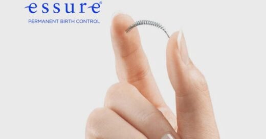 Thousands of women say Essure birth control caused intense pain