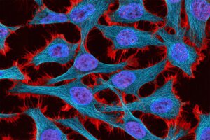 Gene circuits enable more precise control of gene therapy | MIT News
