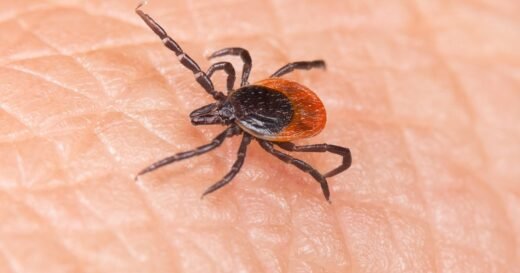 Tick bites are sending more people to the ER this summer. Experts explain why.