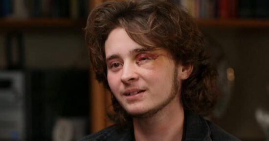 21-year-old says he’s blind in left eye after federal agent shot him with less-lethal round at California protest