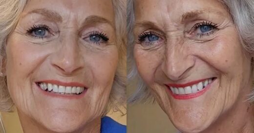 Smoker says 35p-a-day whitener stopped dentist’s stain assessment