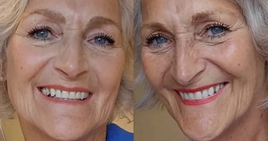 Smoker says 35p-a-day whitener stopped dentist’s stain assessment