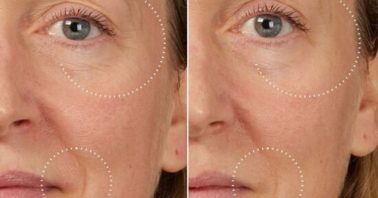 ‘This peptide serum has transformed my 60-year-old skin’