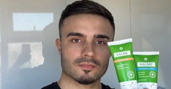 Rosacea sufferers find £27 cream that ‘repairs’ redness at night