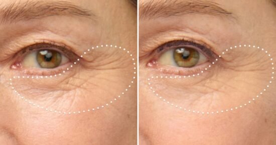 Trinny London fans praise new primer that ‘blurs out’ deep wrinkles
