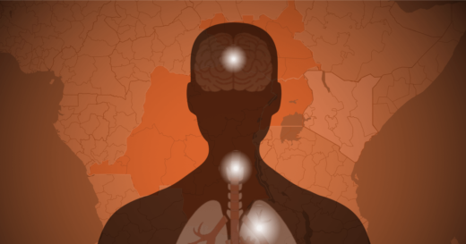 Locations, severity, how contagious it is and more
