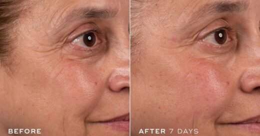 Medik8’s £27 anti-ageing cream ‘incredible’ for ‘smoothing out lines’