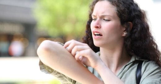 Mosquito bites stop itching fast with doctor’s free tip