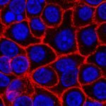 New drug nearly doubles survival rates in some pancreatic cancer patients, study says