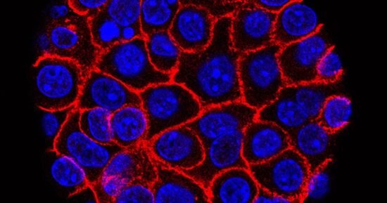 What makes promising pancreatic cancer drug different from chemotherapy?