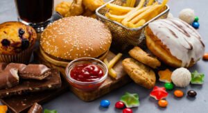 Metabolic Dysfunction-Associated Steatotic Liver Disease (MASLD)