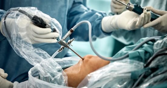 Common knee surgery may do more harm than good: “I don’t know how I would defend this procedure”