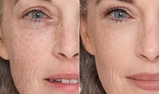 Charlotte Tilbury concealer 'doesn't crease' on mature skin and 'lasts all day'
