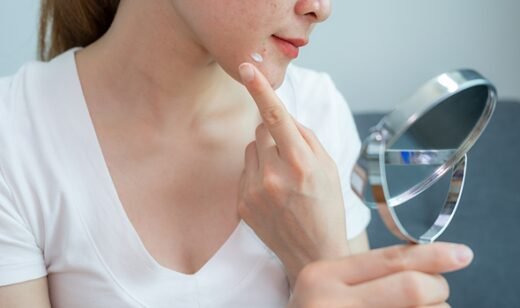Doctor made a 'Holy Grail' acne gel that 'reduces redness' for blemish-prone skin