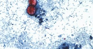 Cyclospora outbreak linked to recalled iceberg lettuce tied to 3 more states, FDA says
