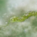 Louisiana reports 5 deaths, 9 cases of flesh-eating bacteria