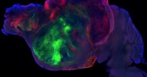 Neuroscientist explains how his team grew human brain tissue in mice and breaks down what they found