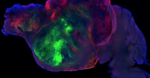 Neuroscientist explains how his team grew human brain tissue in mice and breaks down what they found
