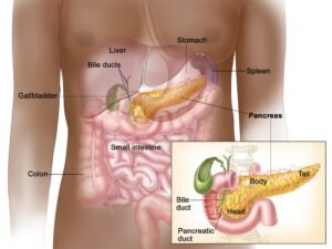 What Are Neuroendocrine Pancreas Tumors?