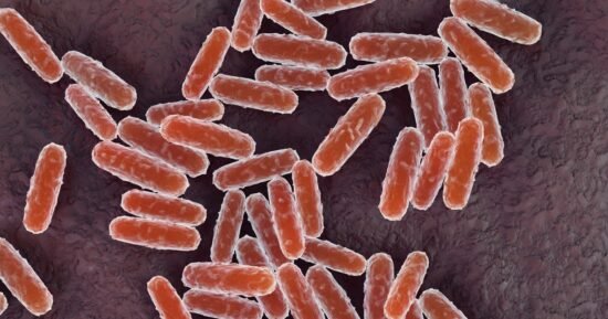 What is pneumonic plague? What to know after woman in Russia diesmysteriously