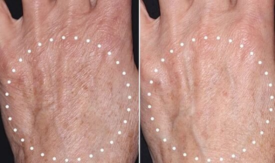 Trinny London's new anti-ageing skincare gives fans 'hands I had in my 20s'