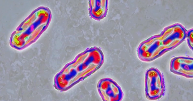 Medical experts on plague risks after reported death of lab worker in Russia